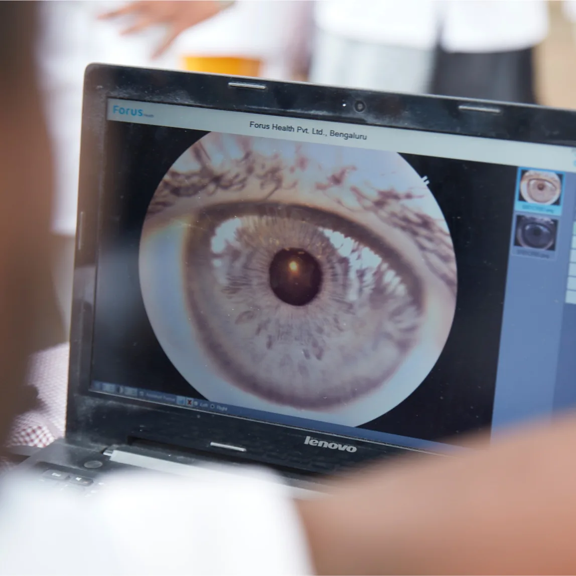 An image of a person's eye on a laptop screen.