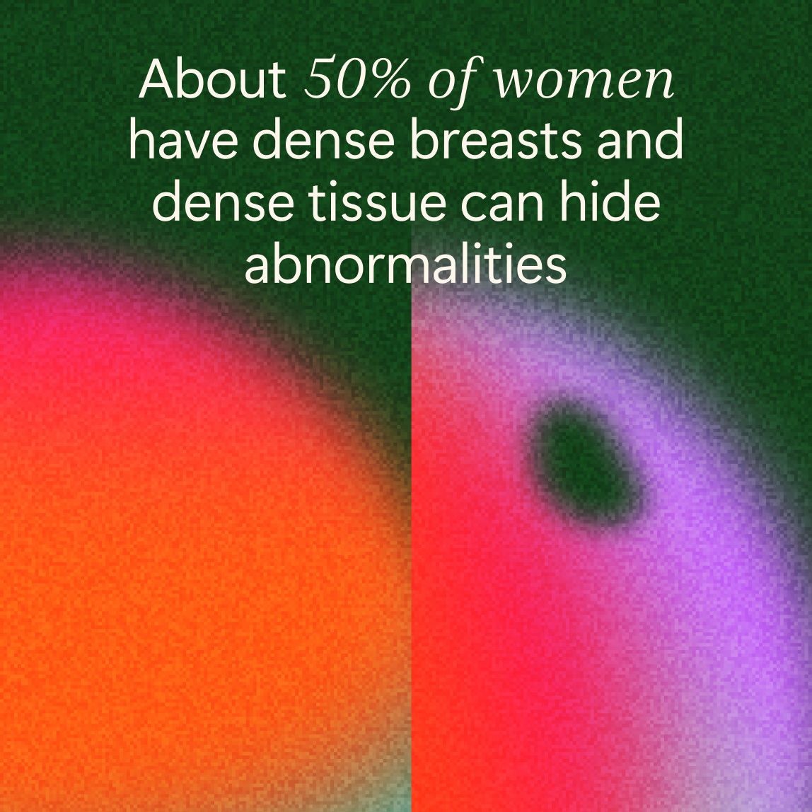 Text reads: "About 50% of women have dense breasts and dense tissue can hide abnormalities," over an abstract background with vibrant gradient colors.