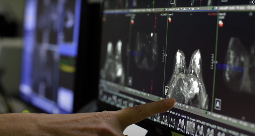 A hand points at a set of brain scan images displayed on multiple monitors.