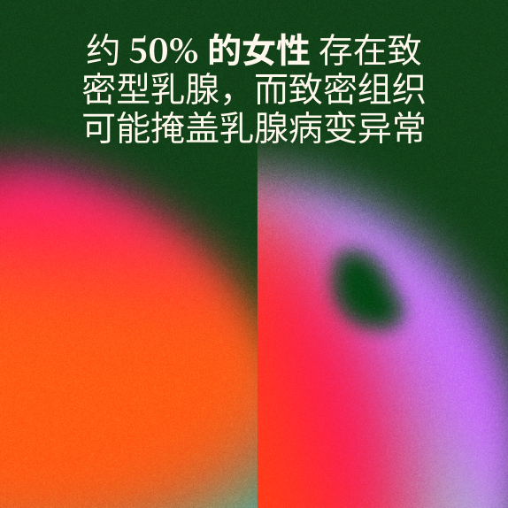 绿色背景上的白色中文文字，配以抽象的粉色和橙色柔和图形。文字讲述了致密乳腺组织影响着约 50%的女性，并有可能掩盖乳房异常。.