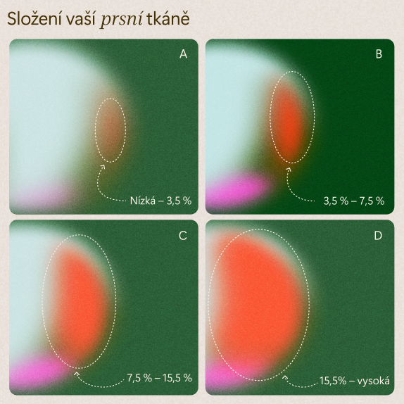 Schéma se čtyřmi rozmazanými obrázky označenými A-D, z nichž každý zobrazuje barevnou oválnou oblast. Oválné plochy se od A do D zvětšují a jejich intenzita se zvyšuje v procentech: A (3,5 %), B (3,5-7,5 %), C (7,5-15,5 %), D (15,5 %+). Český text nahoře.