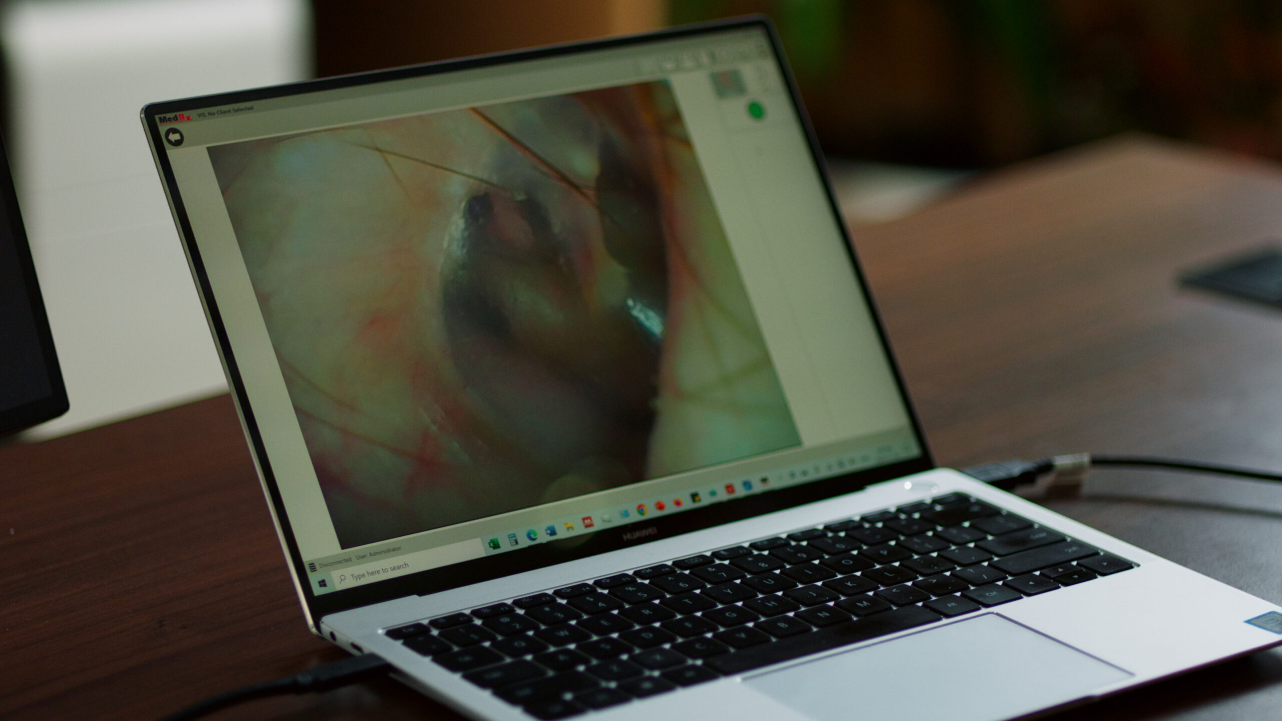 A laptop on a wooden desk displays a close-up medical image.