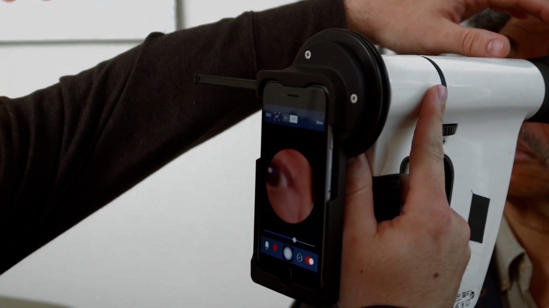A person uses a smartphone attached to a medical device to view an ear canal image on the screen.