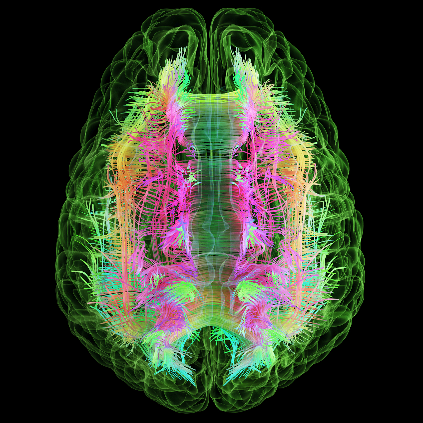 Colorful digital brain visualization showing green neural pathways with pink, yellow, and blue activity patterns against black background.